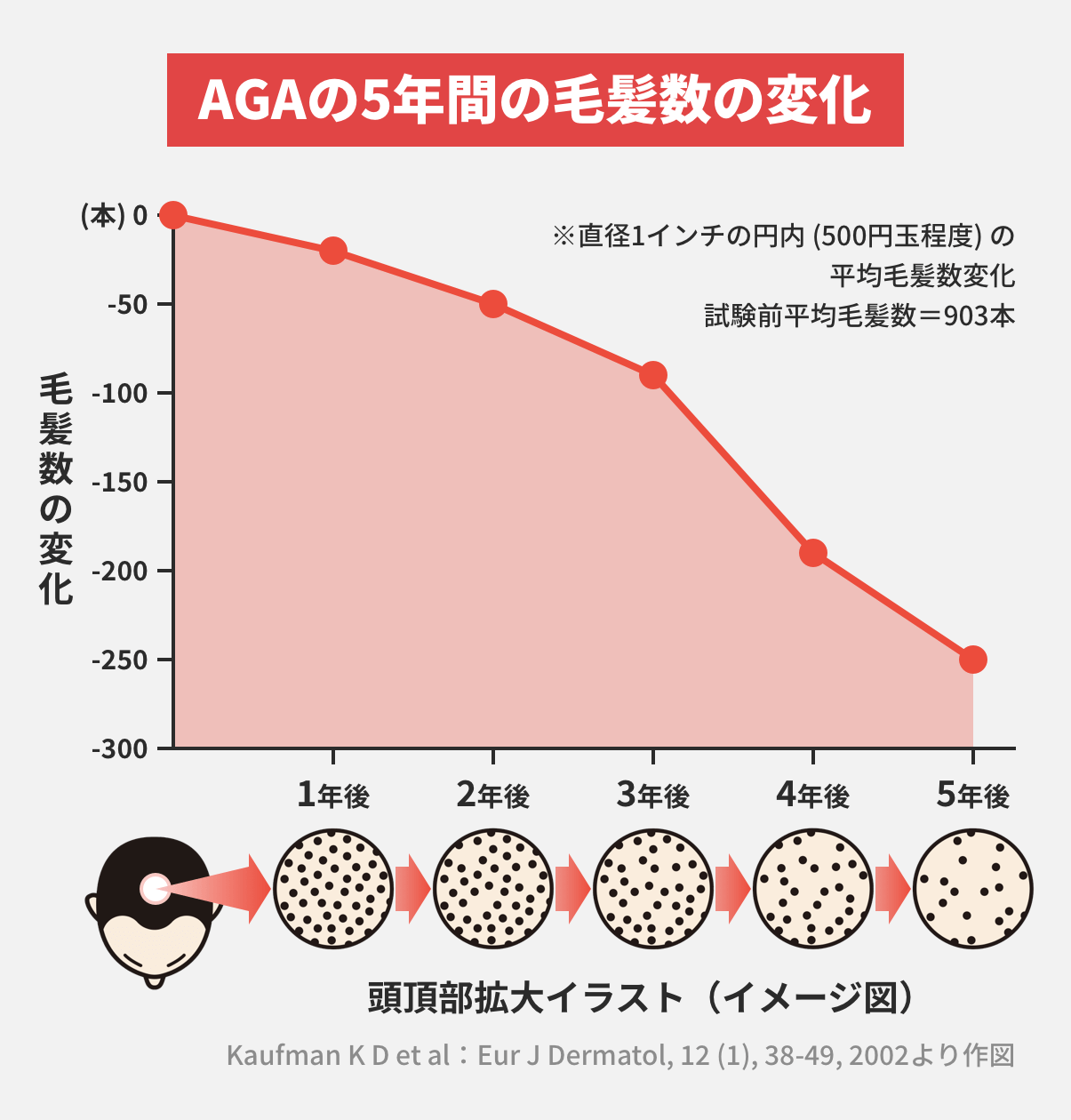 AGAの5年間の毛髪数の変化